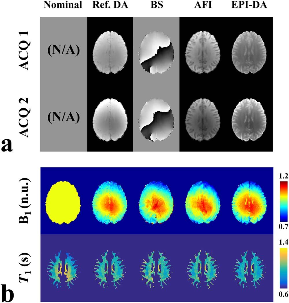 Axial brain images comparing five approaches across two
                      acquisitions: nominal, reference double angle, Bloch-Siegert,
                      actual flip angle imaging, and echo-planar double angle. Below,
                      the corresponding B1 maps in a rainbow colour scale and the
                      resulting T1 maps.