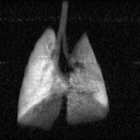 Coronal MRI of a rat lung filled with hyperpolarized helium-3.
                          Both lungs appear bright against a black chest, with the
                          airway visible down the midline.